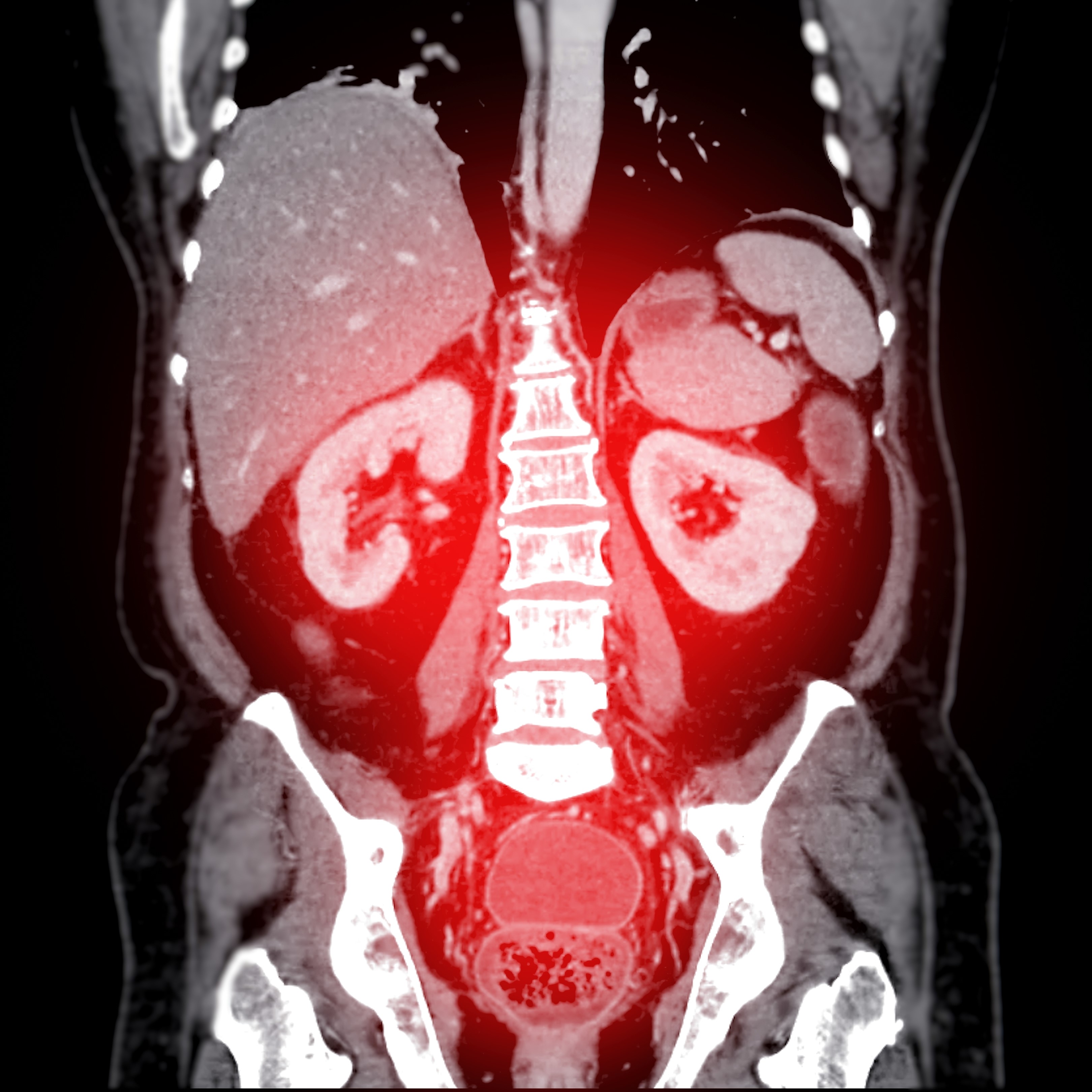 Especialização Médica - Radiologia/Diagnóstico por Imagem – radiologia do abdome