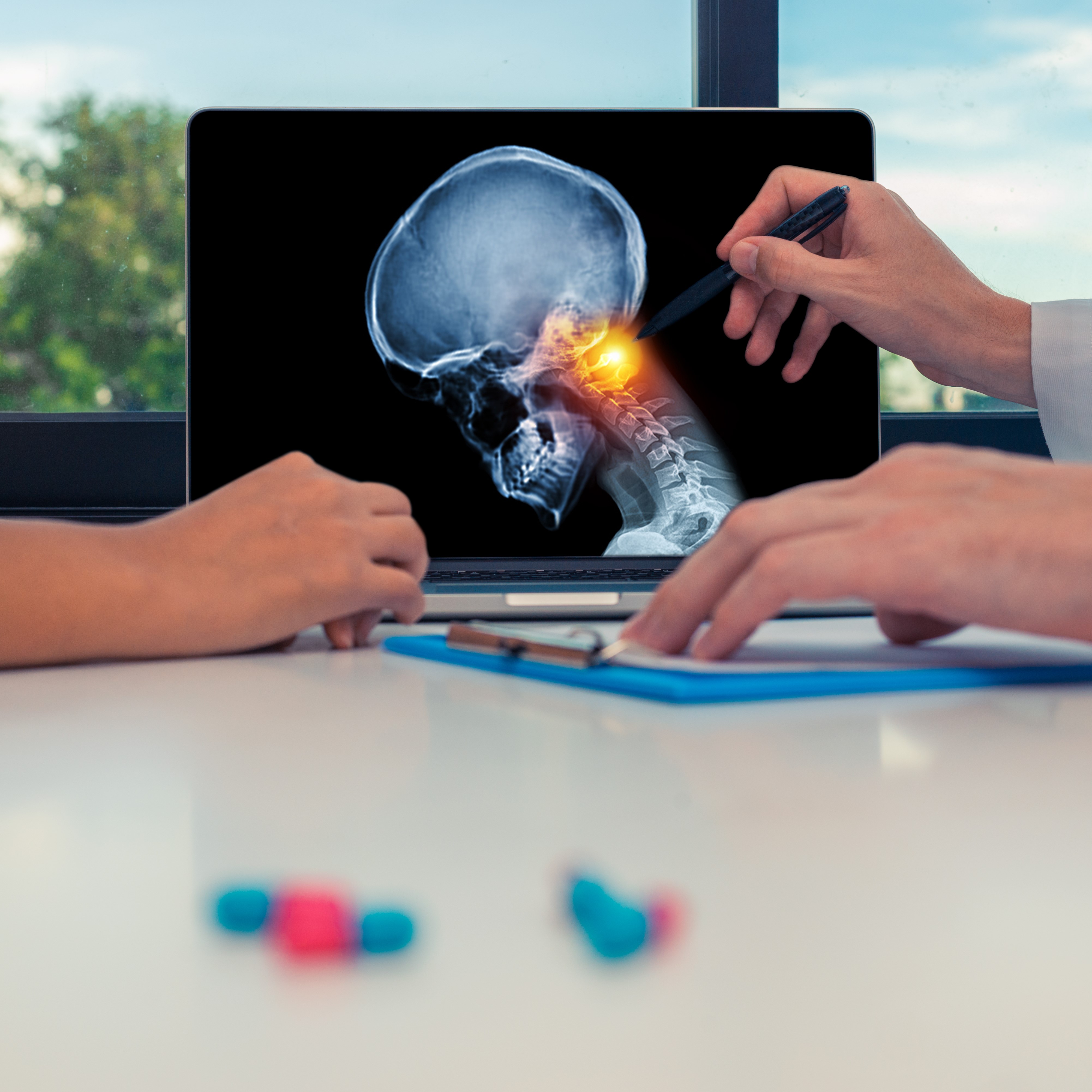 Especialização Médica - Radiologia/Diagnóstico por Imagem – Neurorradiologia e Cabeça e Pescoço