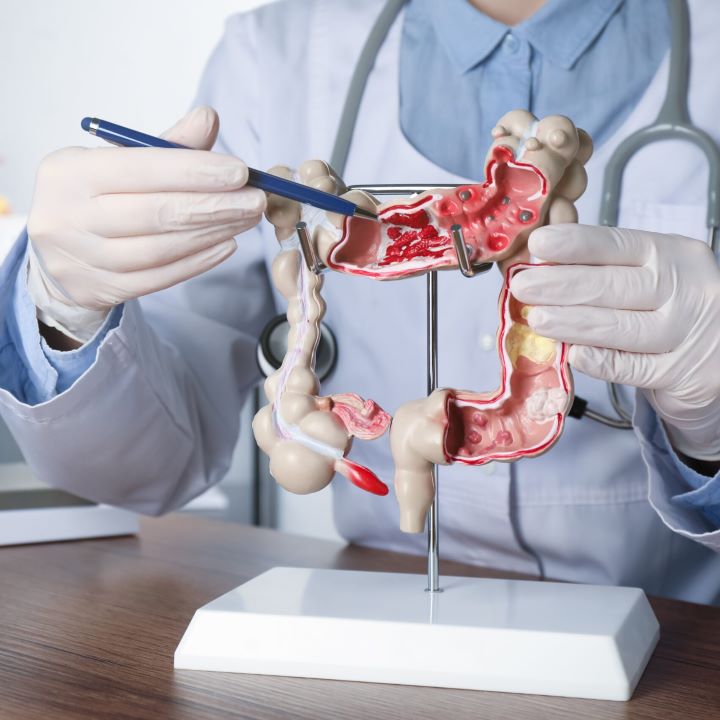 Coloproctologia e Robótica